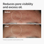 The Ordinary - Niacinamide 10% + Zinc 1%  Serum for Oily Skin