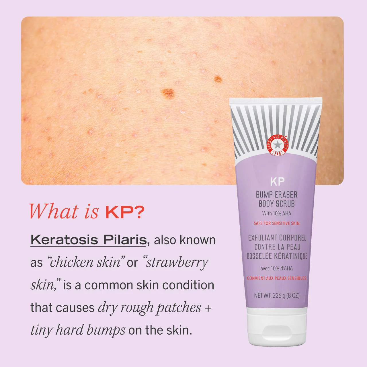 KP Bump Eraser Body Scrub with 10% AHA