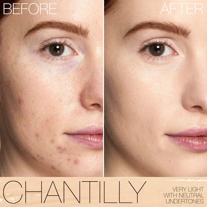 Nars - Radiant Creamy Concealer with Hydrating Medium Coverage