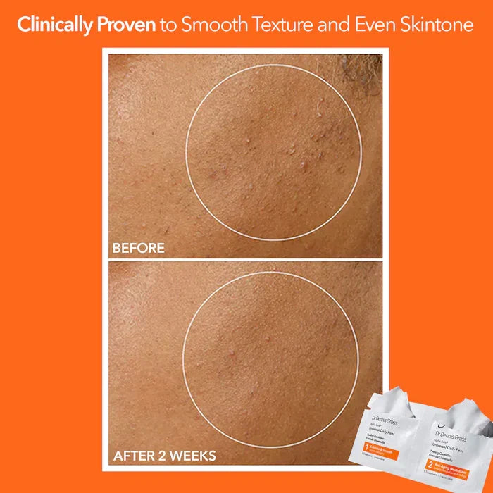 Dr. Dennis Gross Skincare - Alpha Beta® Universal Daily Peel Pads