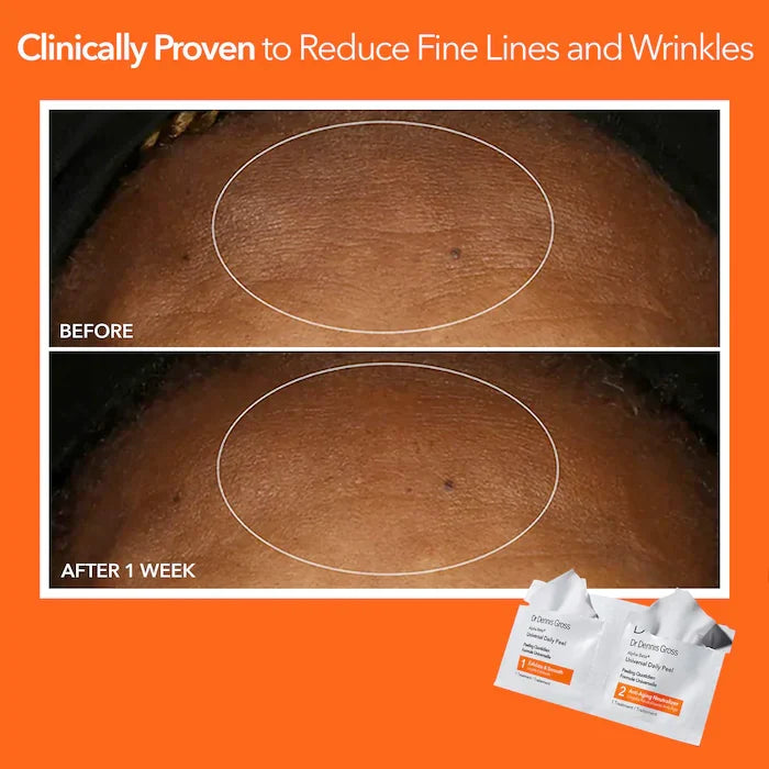 Dr. Dennis Gross Skincare - Alpha Beta® Universal Daily Peel Pads