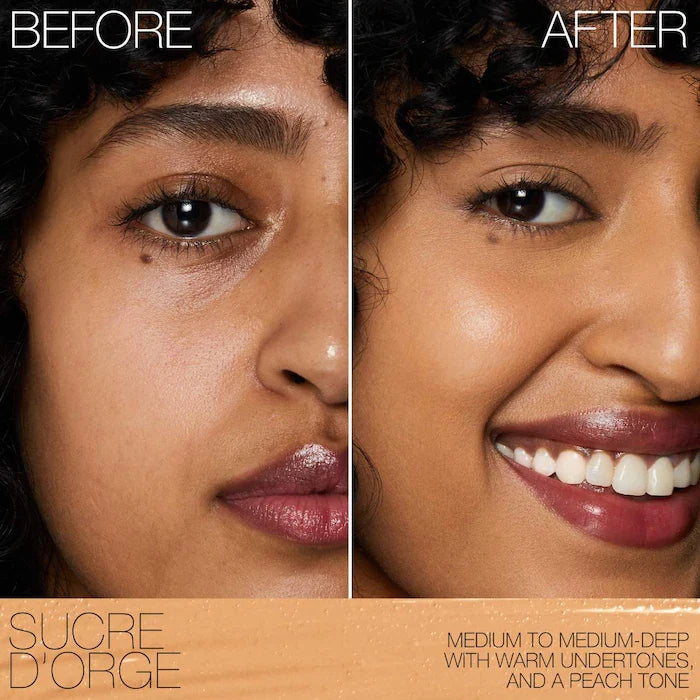 Nars - Radiant Creamy Concealer with Hydrating Medium Coverage