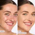 Tarte - shape tape™ full coverage matte concealer