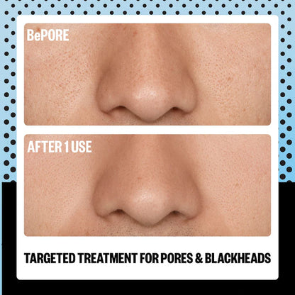 AHA Pore & Blackhead Exfoliator Multitasking Treatment Stick