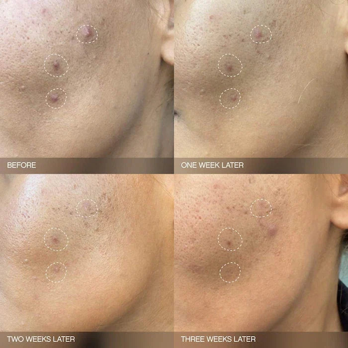 Topicals - Faded Brightening Serum for Dark Spots and Discoloration (UNSCENTED)