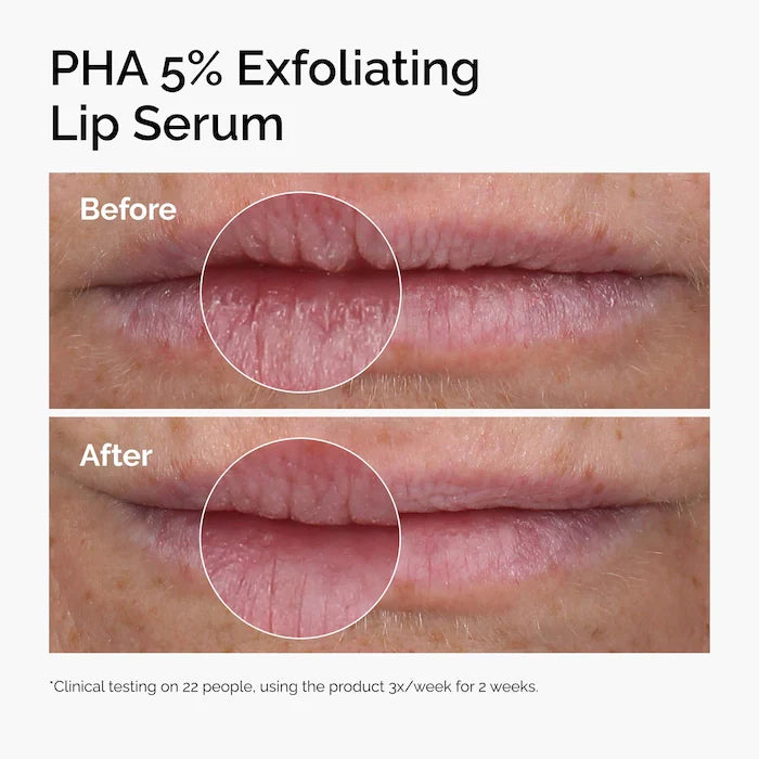The Ordinary- PHA 5% Exfoliating Lip Serum