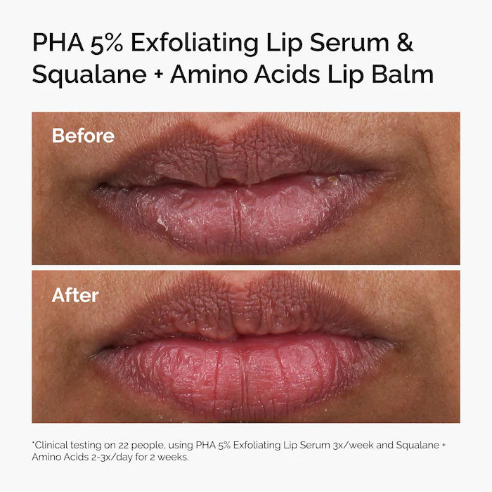 The Ordinary- PHA 5% Exfoliating Lip Serum