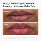 The Ordinary- PHA 5% Exfoliating Lip Serum